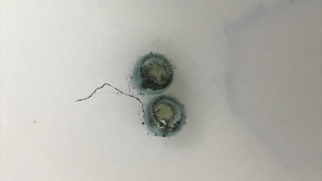 メダカの卵が孵化するまで